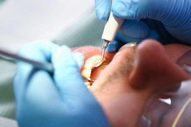 Best Emergency Cosmetic Dentistry in Circleville, OH