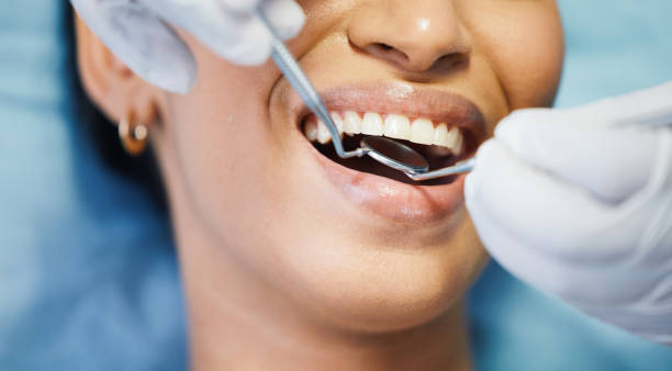 Best Emergency Dental Extractions in Circleville, OH